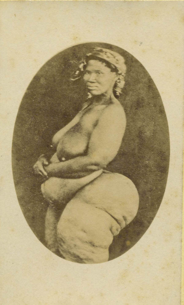 霍屯督妇女，1882年